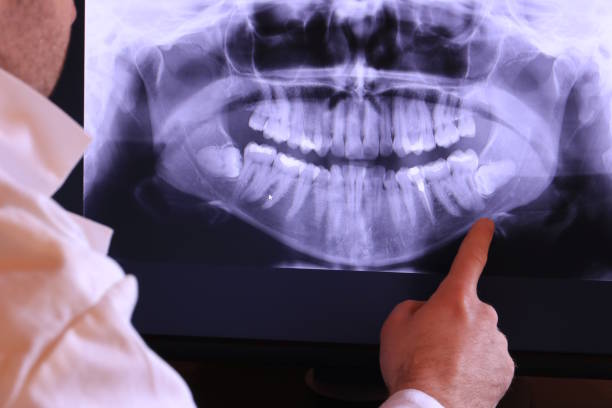 Best Pediatric Emergency Dentist in Aberdeen, MD